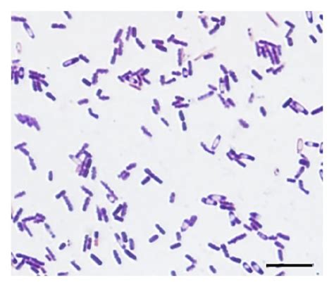 Gram Stain Of The Blood Culture Showing Gram Positive Rods With Spores