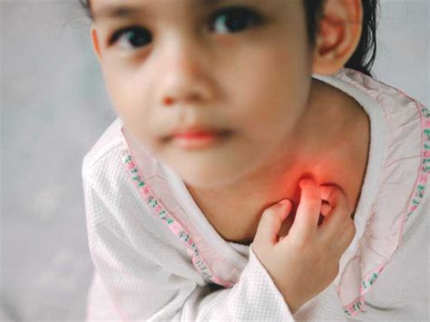 Branchial Cleft Cyst Causes Types And Symptoms