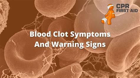 Blood Clot Symptoms And Warning Signs Cpr First Aid