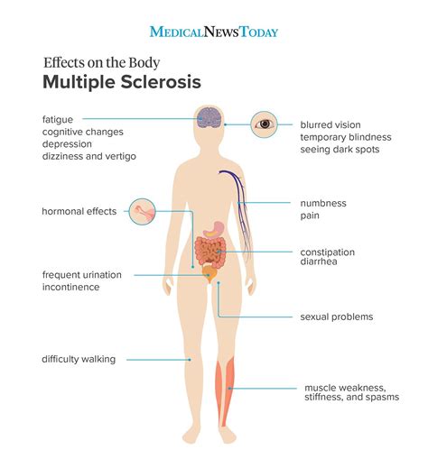 What Is Multiple Sclerosis And How Can An Exercise Routine Help