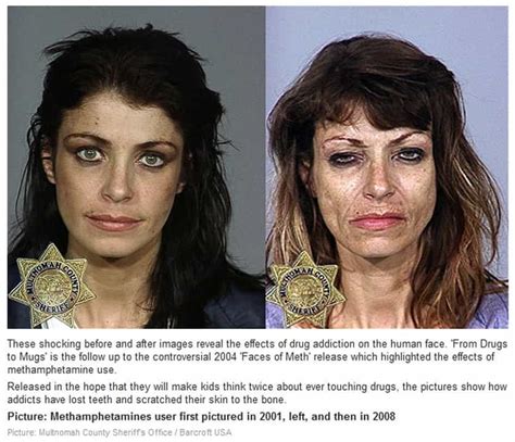 Methamphetamine Before And After Gagdaily News
