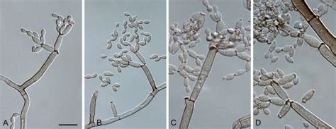 Cladosporium Australiense Cbs 125984 Ab Conidiophores And Conidial