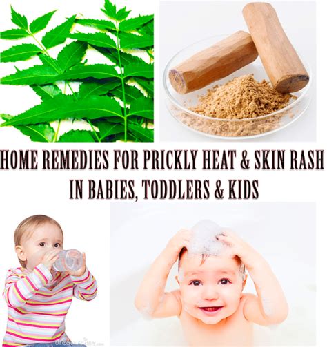 Maha My Life Home Remedies For Prickly Heat Rash On Babies He