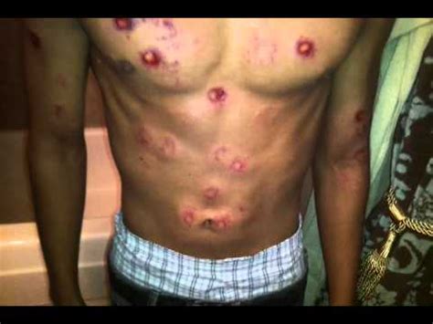 We did not find results for: Full Auto 50 Paintballs; The Aftermath - YouTube