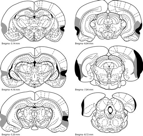 Double Dissociation Between The Effects Of Peri Postrhinal Cortex And