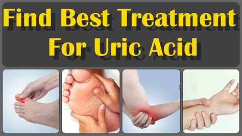 Best Treatment For High Uric Acid And Find Best Treatment For Uric Acid Youtube