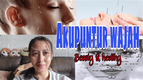 Sinau Bareng Manfaat Akupuntur Wajah Beauty And Healthykinarsih