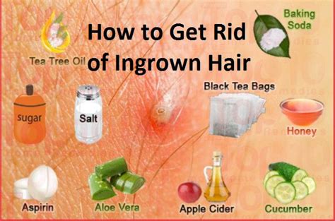 How To Get Rid Of Ingrown Hair