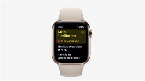 The Apple Watch Series 4 Ecg Test And Atrial Fibrillation Features Health