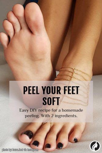 Practical Foot Peel Is A Sure Way To Perfect Your Feet ...