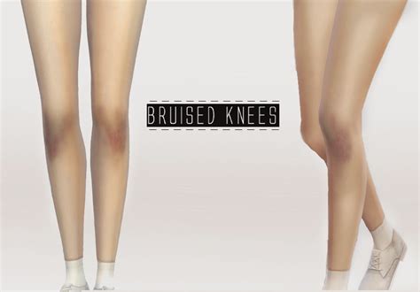 My Sims 4 Blog Bruised Knees By Onelama