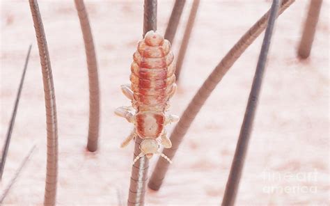 Head Louse Photograph By Sebastian Kaulitzkiscience Photo Library