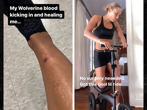 Olympian Lolo Jones Posts Video Of Gruesome Injury She Says Is Bone