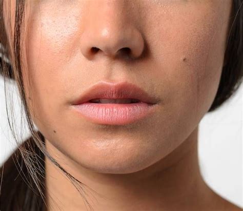 How To Improve Uneven Skin Texture According To Experts
