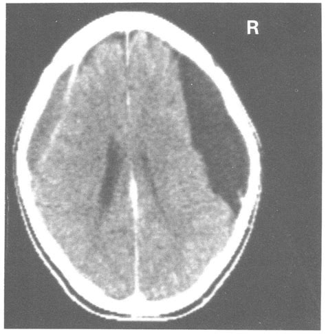 Contrast Enhanced Ct Scan Download Scientific Diagram