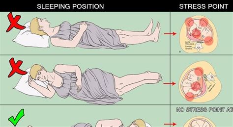 sleeping position during pregnancy with pictures el paso back clinic