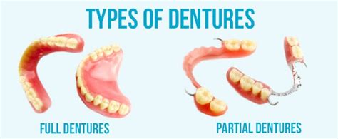 Dentures And Partials A Tooth Replacement Option To Consider