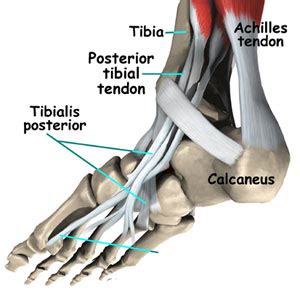 Model deformation of the tendons such that a realistic foot simulation can be obtained. Ankle Tendonitis Information - iTendonitis.com