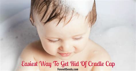 Easiest Way To Get Rid Of Cradle Cap My Favorite Cradle Cap Comb And Brush