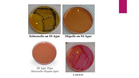 Salmonella differential agar, modified, salmonella chromogen agar, salmonella agar, onoz, hicrome™ selective salmonella agar base. Salmonella-Shigella Agar test: Principle, Composition ...