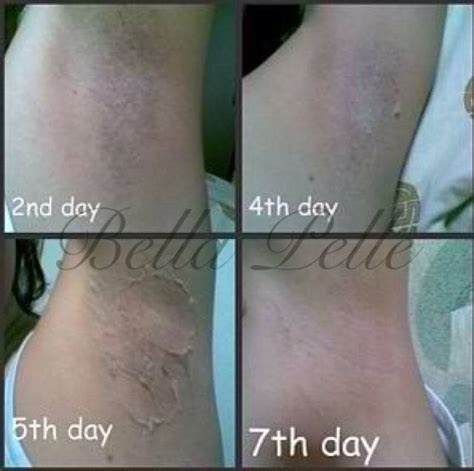 Manila Shopper Bella Pelle Organic Underarm Skin Whitening Treatment