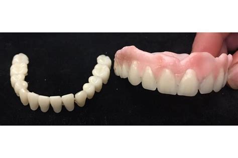 Diy denture 1/3 impression and plaster mold. Do It Yourself Denture Kit False Teeth Plus Dental ...