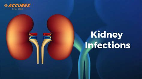 Kidney Infections Symptoms Causes Diagnosis And Treatment