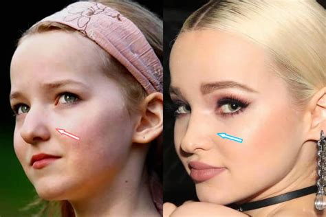 Dove Cameron Before And After 2020