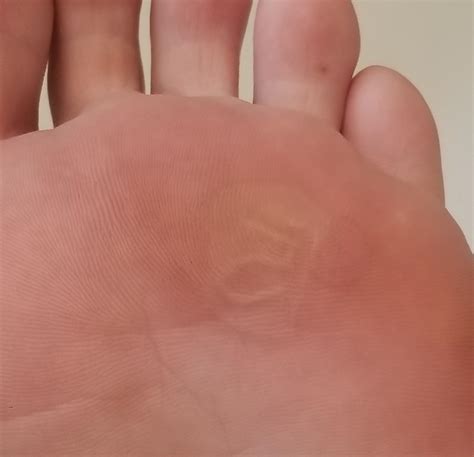 My Blister Healed Now My Foot Print Has A 5 Rmildlyinteresting
