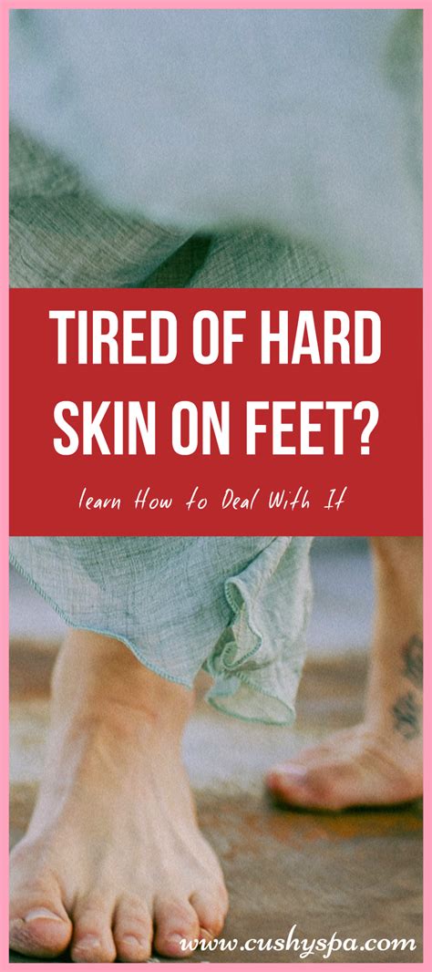 How To Get Rid Of Dead Skin On Feet Step By Step Guide Dead Skin On
