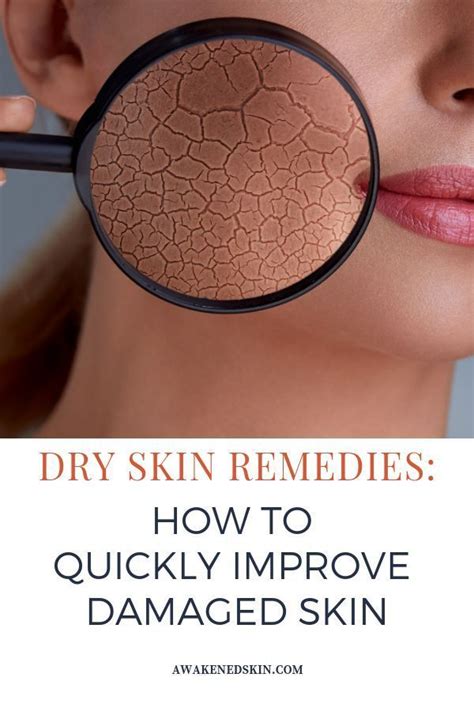 Dry Skin Remedies How To Quickly Improve Damaged Skin Natural Skin