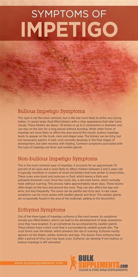 Impetigo Symptoms Causes And Treatment