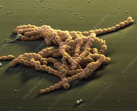 Streptococcus Agalactiae Bacteria Coloured Sem Stock Image B236 0136 Science Photo Library