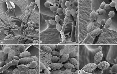 Cladosporium Versiforme Cbs 140491 A Conidiophores Sprouting From
