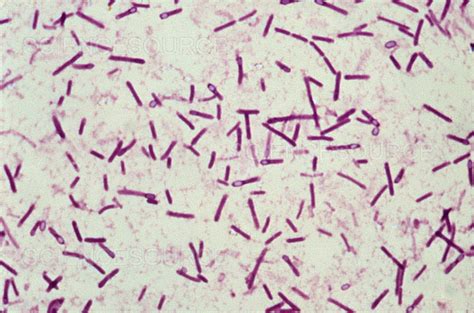 Photograph Clostridium Botulinum Lm Science Source Images