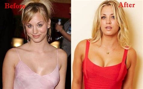 Kaley Cuoco Plastic Surgery Before And After Kaley Cuoco Plastic Surgery Kayley Cuoco