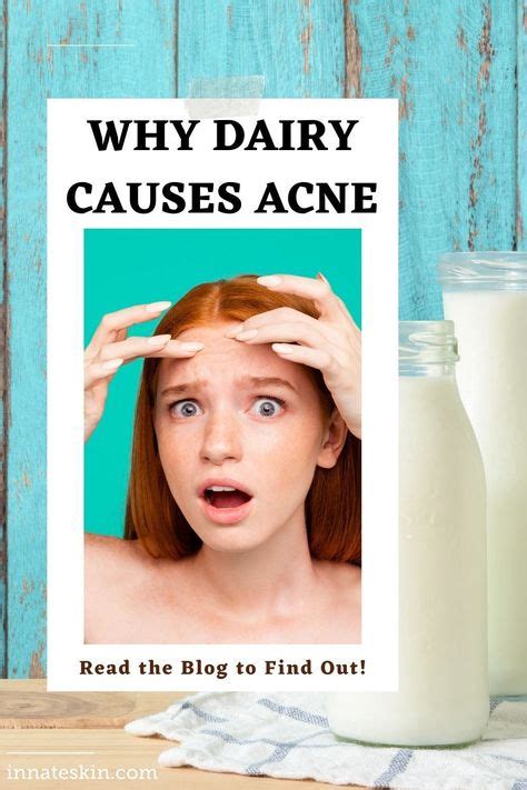 Why Dairy Causes Acne