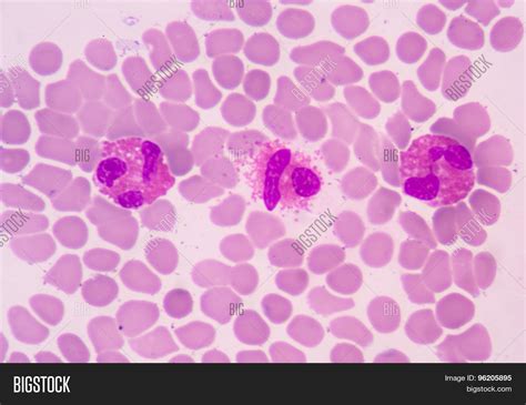 White Blood Cells Image And Photo Free Trial Bigstock