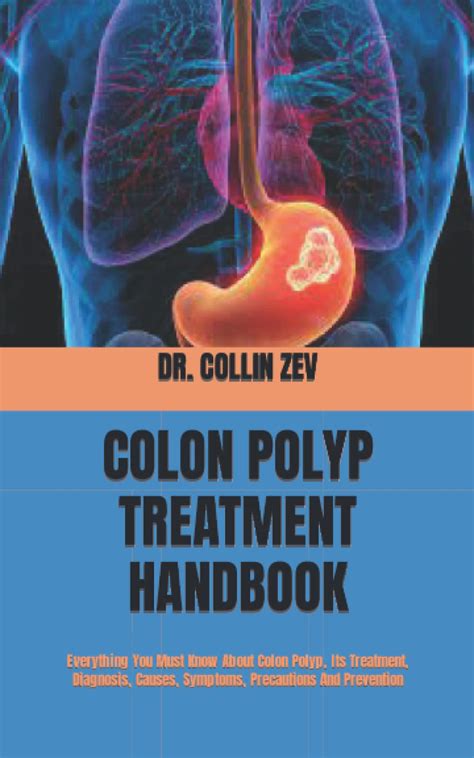 Buy Colon Polyp Handbook Everything You Must Know About Colon Polyp
