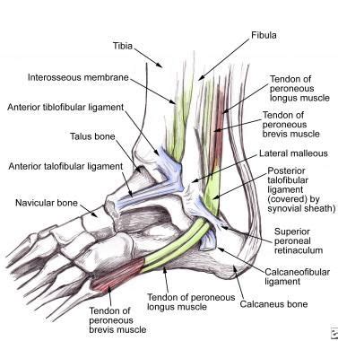 The superior peroneal retinaculum is torn at the fibula, and peroneal tendon dislocation occurs with dynamic evaluation in ankle dorsiflexion and eversion. Lateral ankle anatomy demonstrates the peroneal te | Torn ...