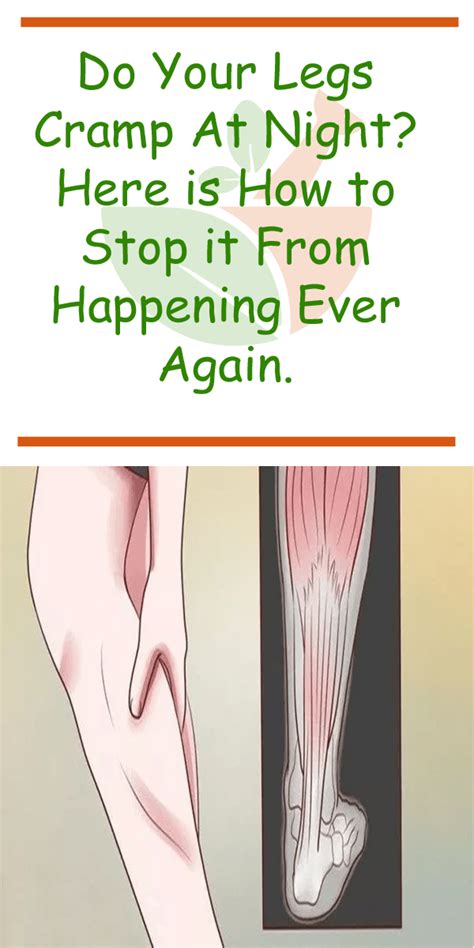 Do Your Legs Cramp At Night Here Is How To Stop It From Happening Ever Again Leg Cramps Leg