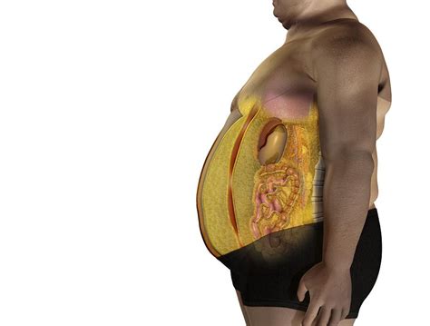 Fat On Inner Organs Artwork Photograph By Claus Lunau Fine Art America