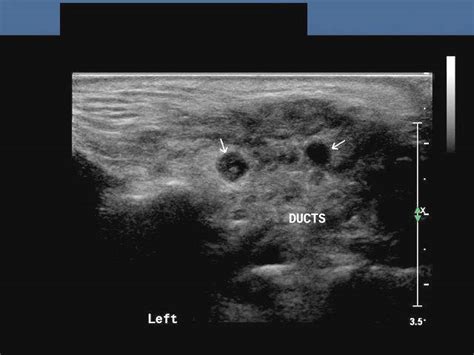 A Gallery Of High Resolution Ultrasound Color Doppler And 3d Images