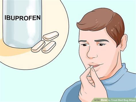 How To Treat Bed Bug Bites 12 Steps With Pictures Wikihow