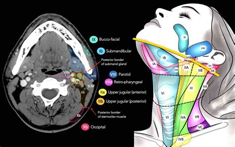 The Radiology Assistant Cervical Lymph Node Map 2023