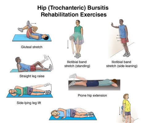 Hip Trochanteric Bursitis Exercises Illustration Hip Bursitis My XXX Hot Girl