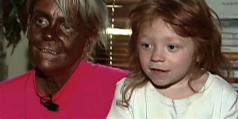 Mother Accused Of Letting Daughter 6 Use Tanning Bed Videos Cbs News