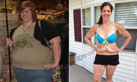 Woman Who Lost 172 Pounds Told To Cover Up Her Stomach By Magazine
