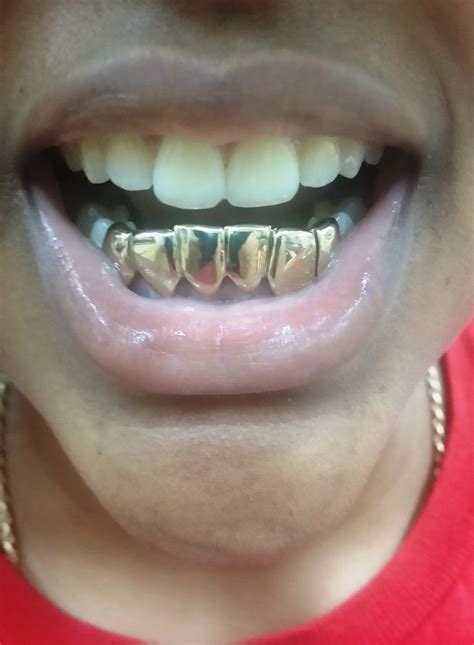 Florida Gold Teeth Gold Grillz Miami On Twitter 66 14k Solid Yellowgold Grillz