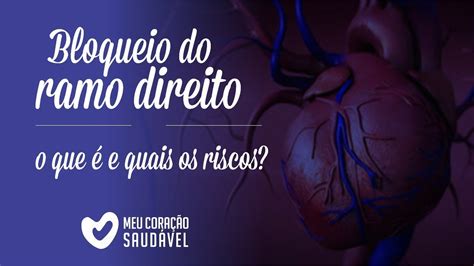 Bloqueio De Ramo Direito Pode Matar
